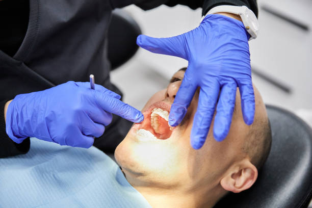 Best After-Hours Dental Trauma Care in Harvey, ND